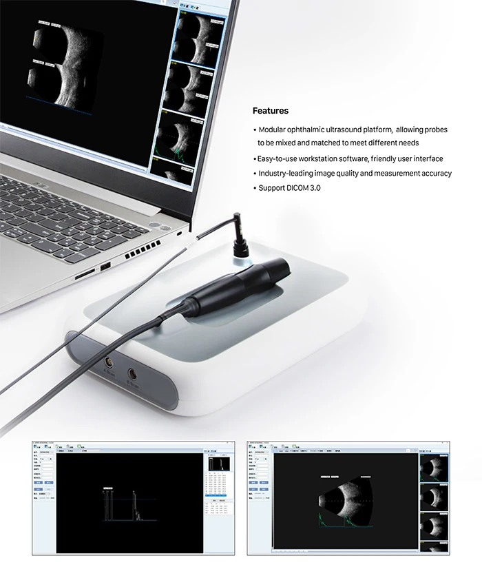 SW-2100 China ophthalmic equipment ultrasound a AB ecobiometry scanner ophthalmology AB Scan