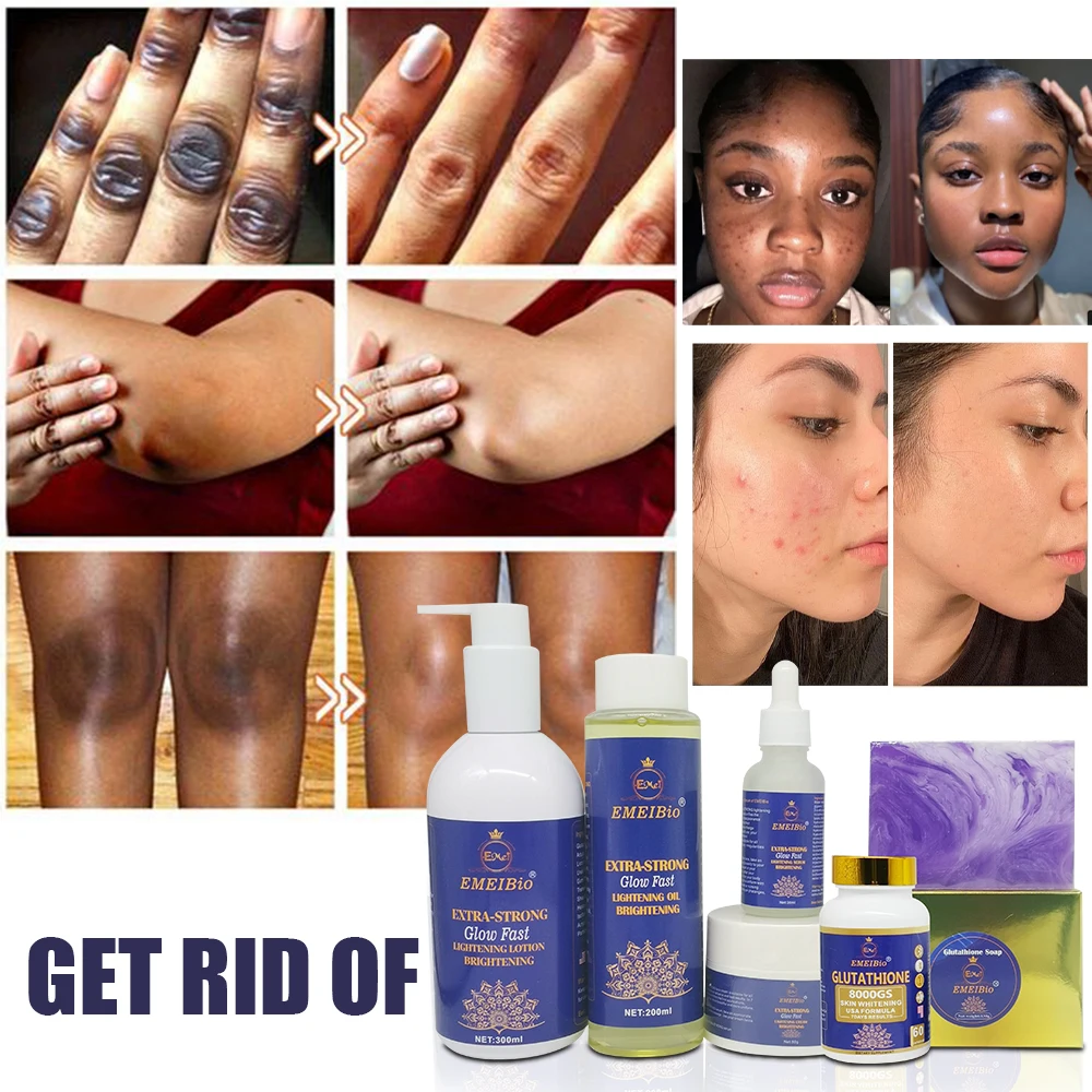 glutathione soap and lotion Wholesale OEM Glutathione Skin Care Whitening Glowing Set Capsule Cream Oil  Soap Lotion Serum Glutathione Skin Whitening Sets