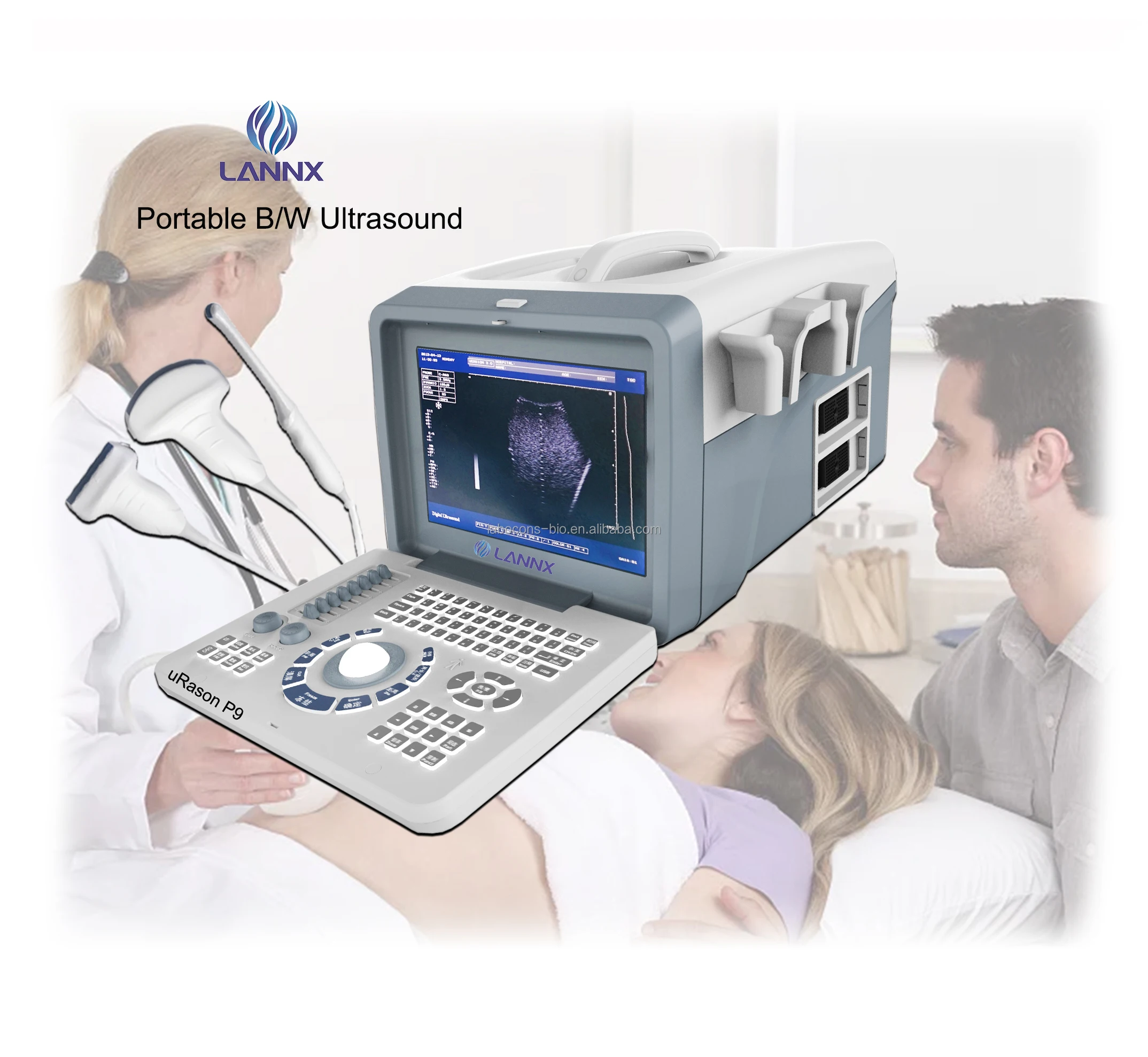 Lannx Urason P9 Original Stock B/w Portable Ultrasound Machine 2d Image ...