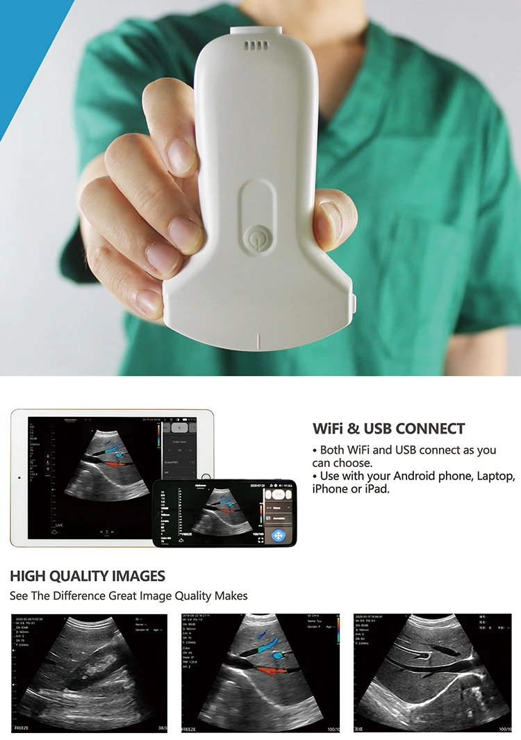 Portable Dual Scanner Wireless Ultrasound Linear Probe 128 Elements High Frequency Handheld Electric Power Made Metal Plastic