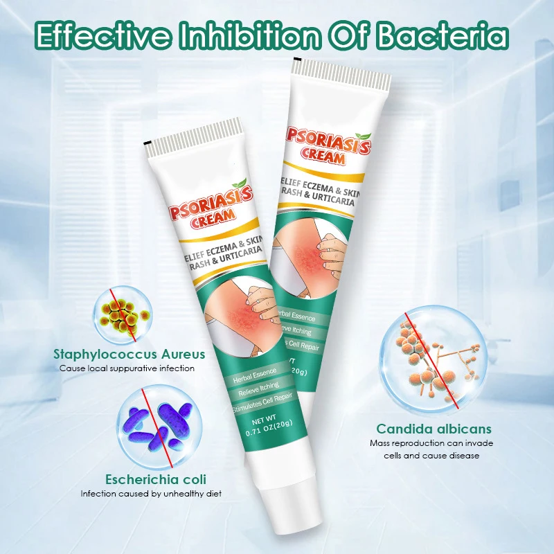 quick effective pure natural chinese herbal dermatitis pruritus psoriasis treatment cream ointment for skin problem
