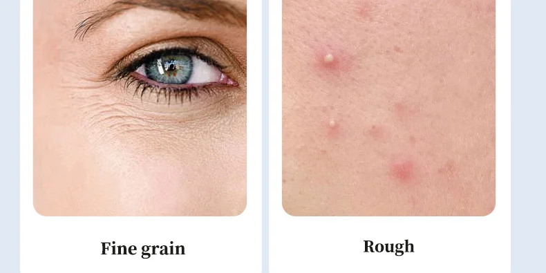 Retinol Moisturizer for Anti-Aging - Moisturizes & Improves Skin Elasticity Suitable for All Skin(pic6)