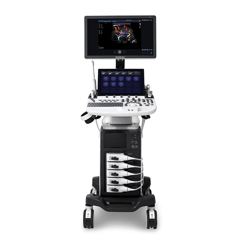Sonoscape P40 Elite Ultrasound machine - Oxyaider 