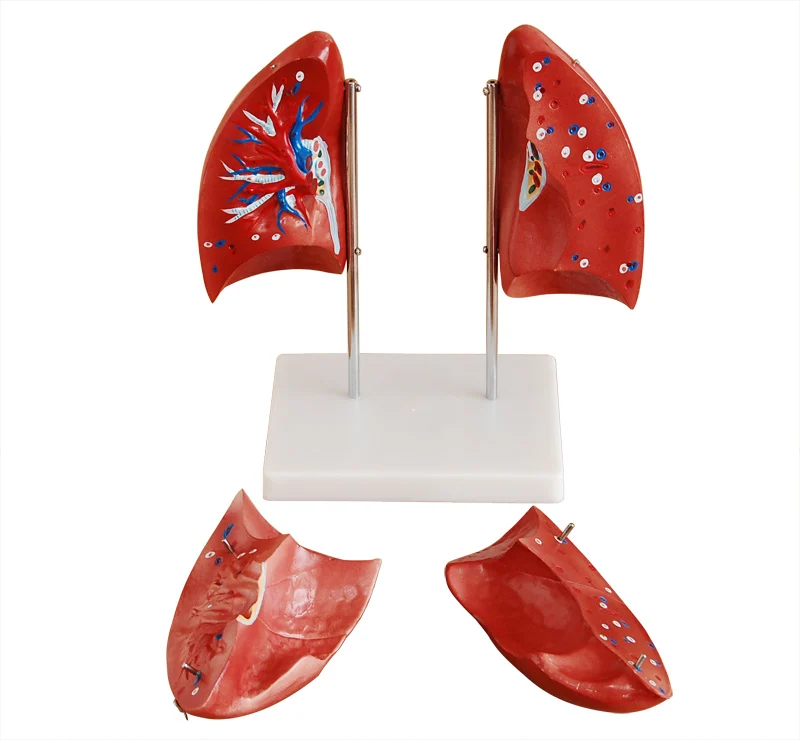 Medical Teaching Used PVC Simulation Human Anatomy Lung Respiratory System Structure Model