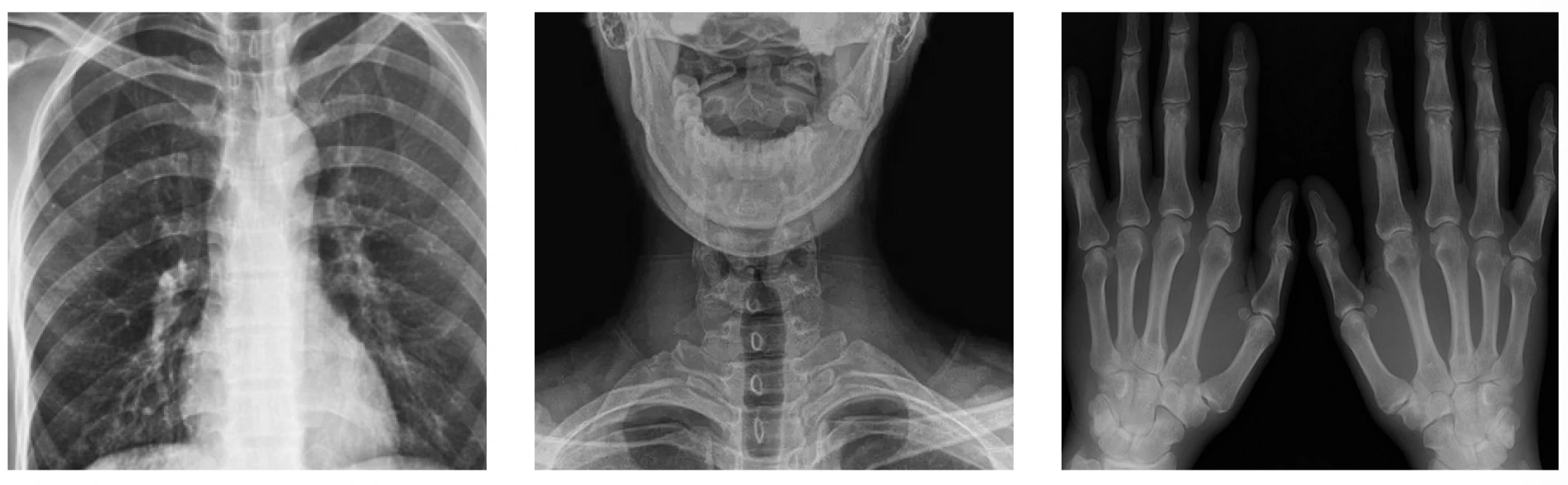 Customer Favorite Medical High-Frequency Equipment H-5RA All-in-one 5kw Portable X-ray Radiography Machine Price factory