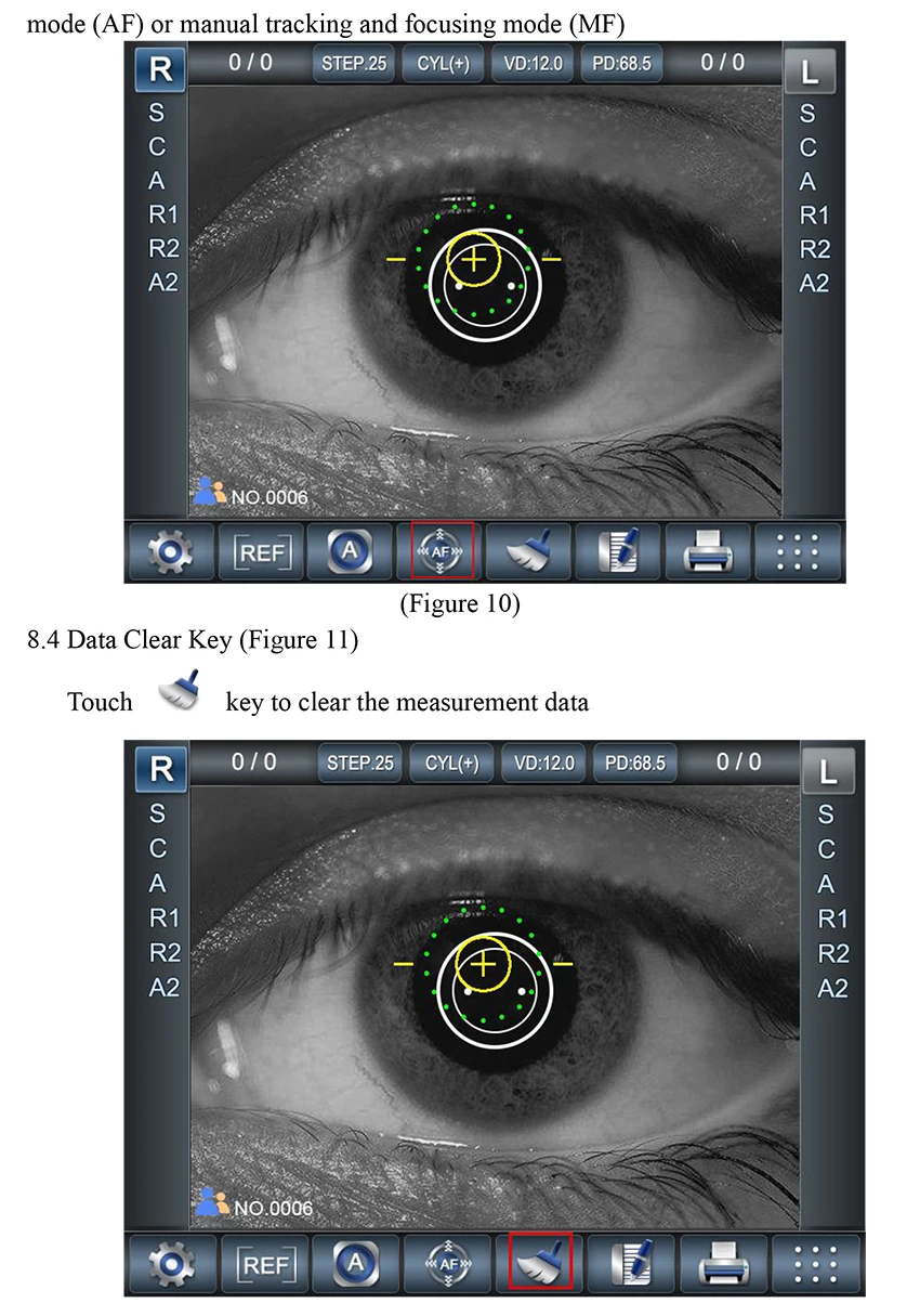 Medical Laboratory Ophthalmology Equipment Auto Refractometer Price