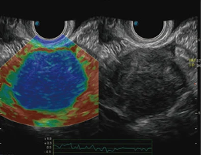 Sonoscape P20 Mobile 3D/4D Real-time Color Panoramic Doppler Trolley Ultrasound Machine supplier