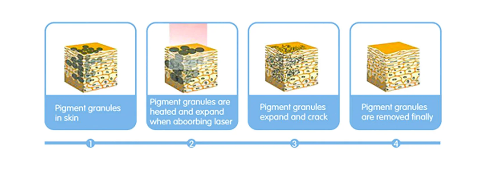 Professional Q Switched Nd Yag Laser eyebrow tattoo Removal
