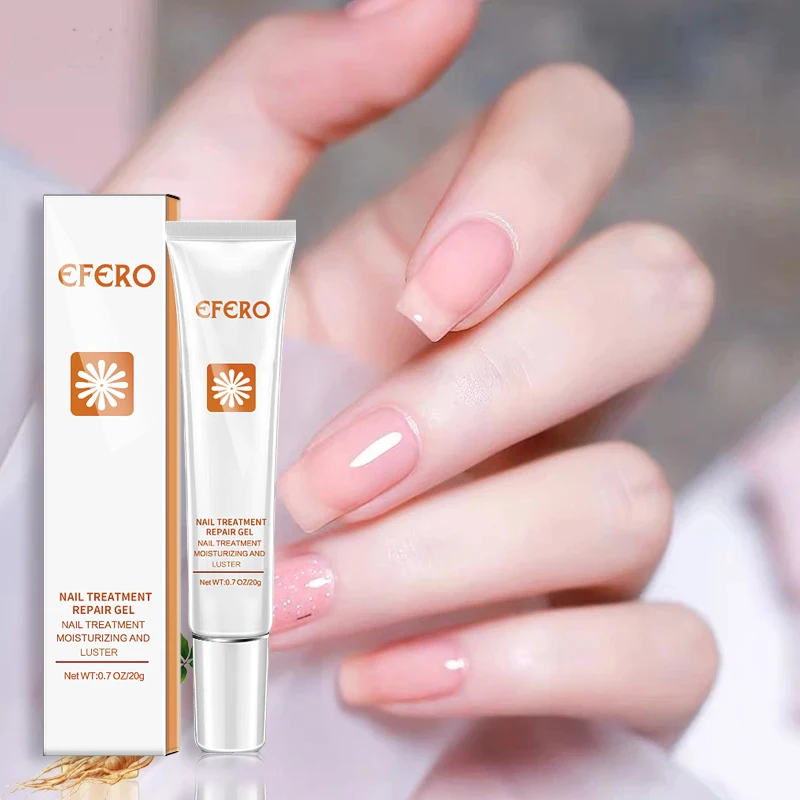 Nail Repair Cream Nail Fungal Treatment Gel Onychomycosis Paronychia