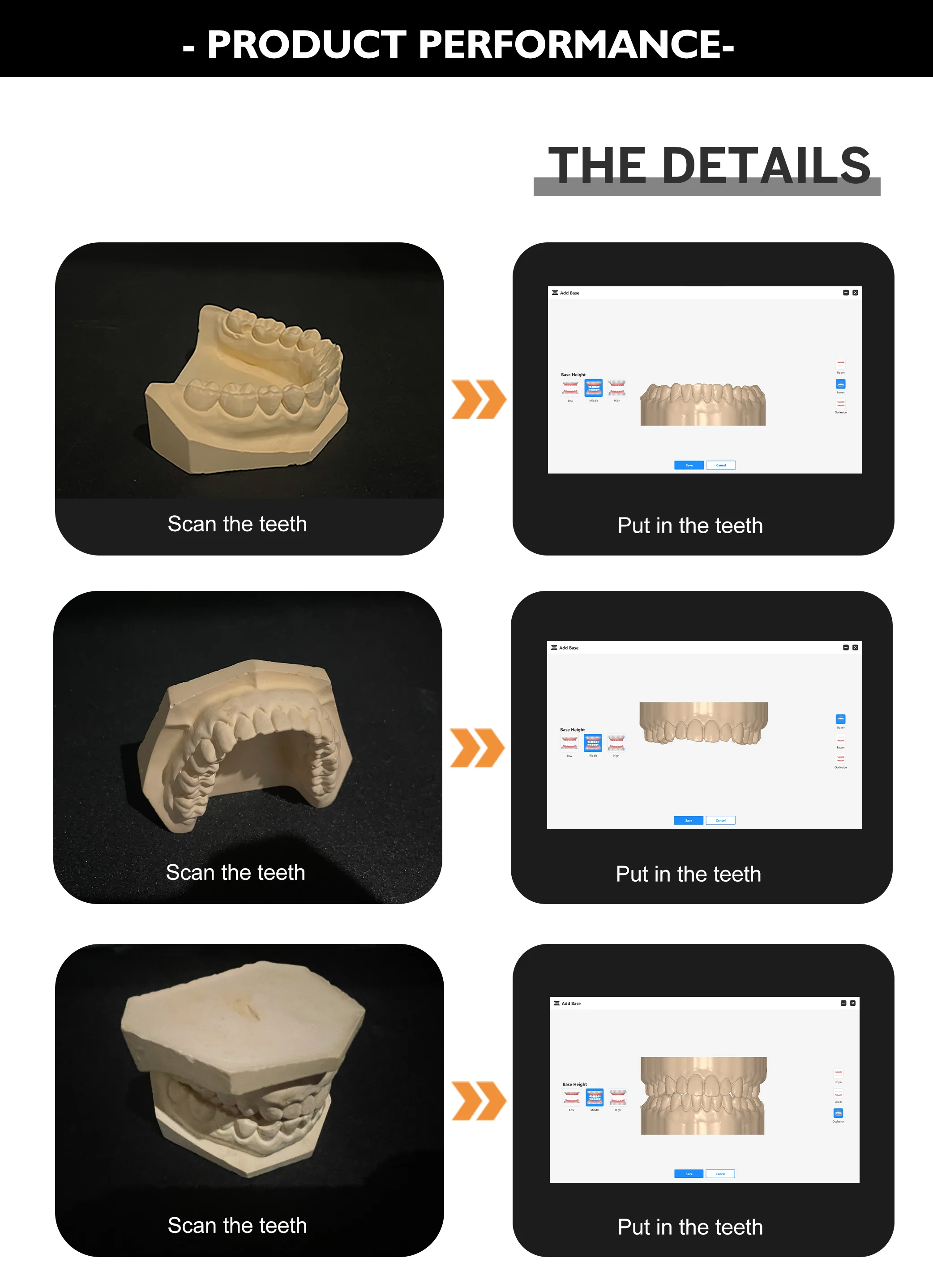 Dental Intraoral Scanner Panda P3