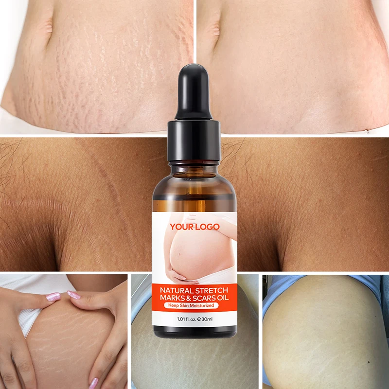 Private Label Natural Marks & Scars Repair Skin Nourishing Smoothing Message Oil Natural Stretch Mark Oil(pic2)