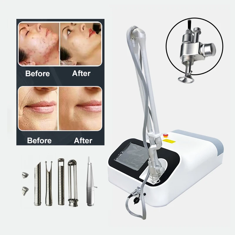 CO2 Laser Fractional Beauty Machine Fraccionado Co2 Laser