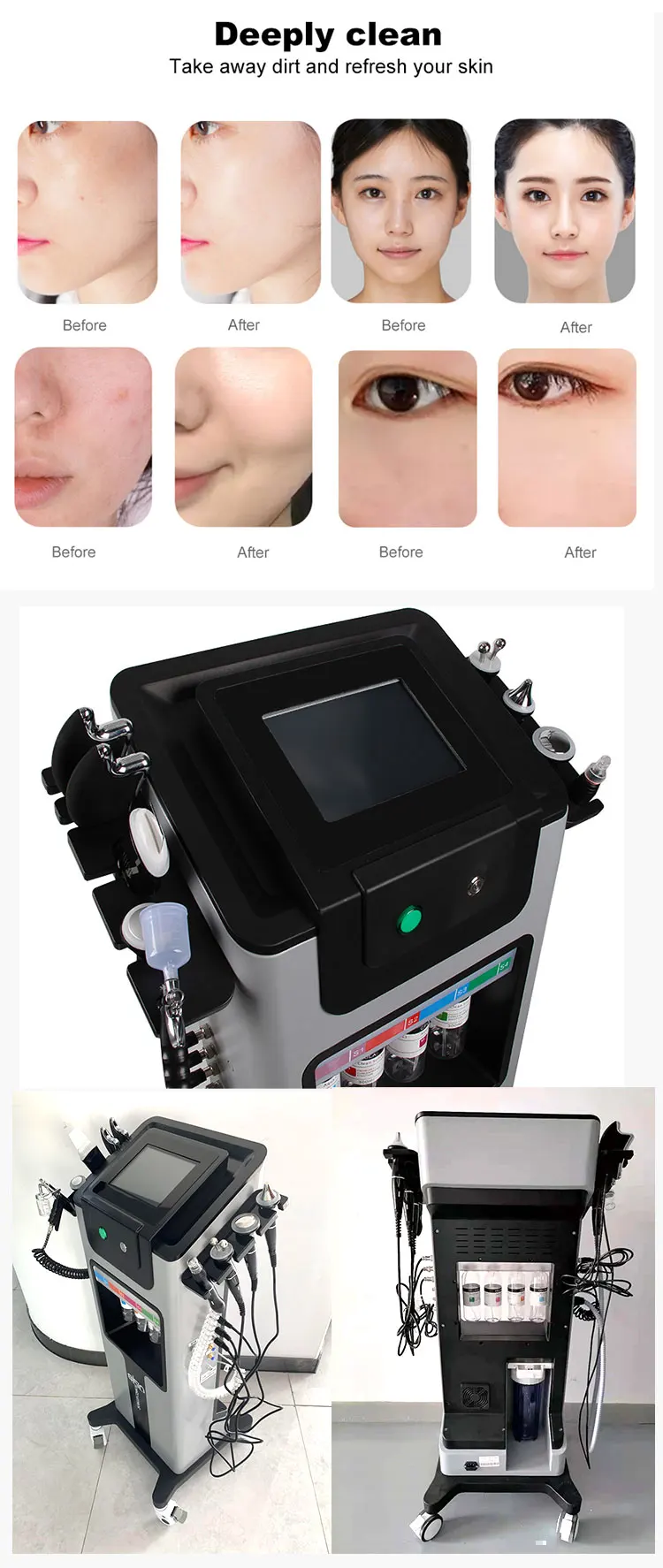 Black Pearl Skin Limpieza Facial Profesional Led Hydrofacials Solution ...