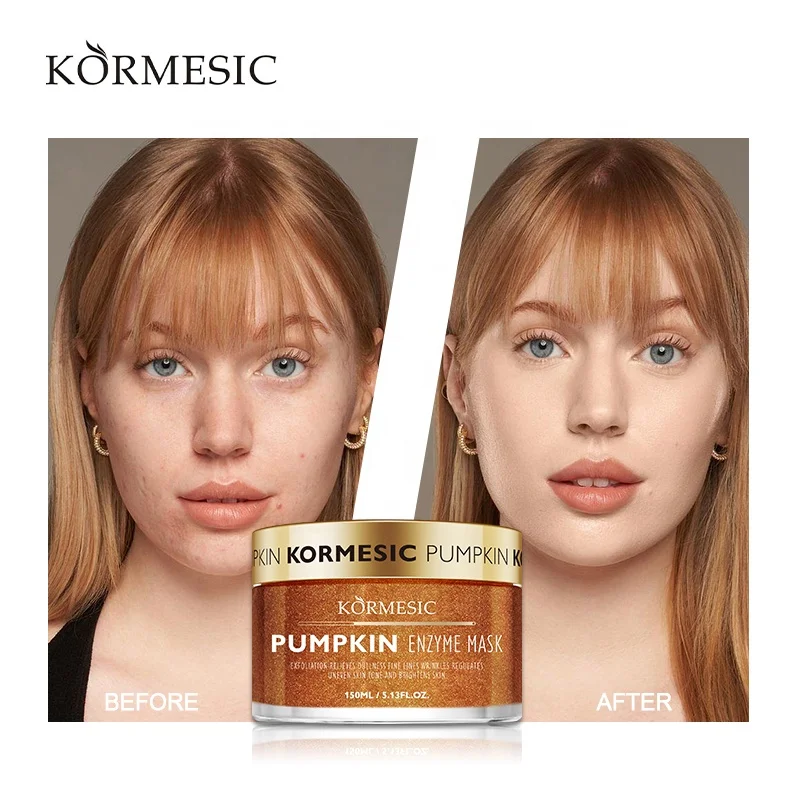 Oem Odm Private Label Kormesic Whitening Moisturizing Anti Aging Hyaluronic  Acid Acne Cream Gel For Face - Buy Face Anti Acne Whitening Cream,Forever