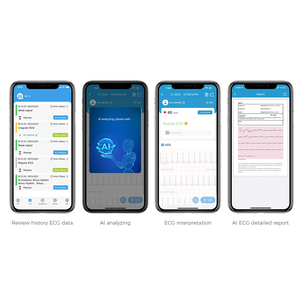 Checkme BP2 Connect Blood Pressure Monitors with AI ECG Analysis, Upper Arm BP  Machine Cuff Kit and EKG Heart Monitor, Supports Wifi & Bluetooth 