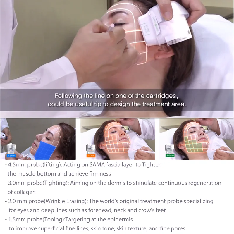 2021 Newest 7D Hifu Body And Face Slimming Machine Hifu 7D For Winkle Removal
