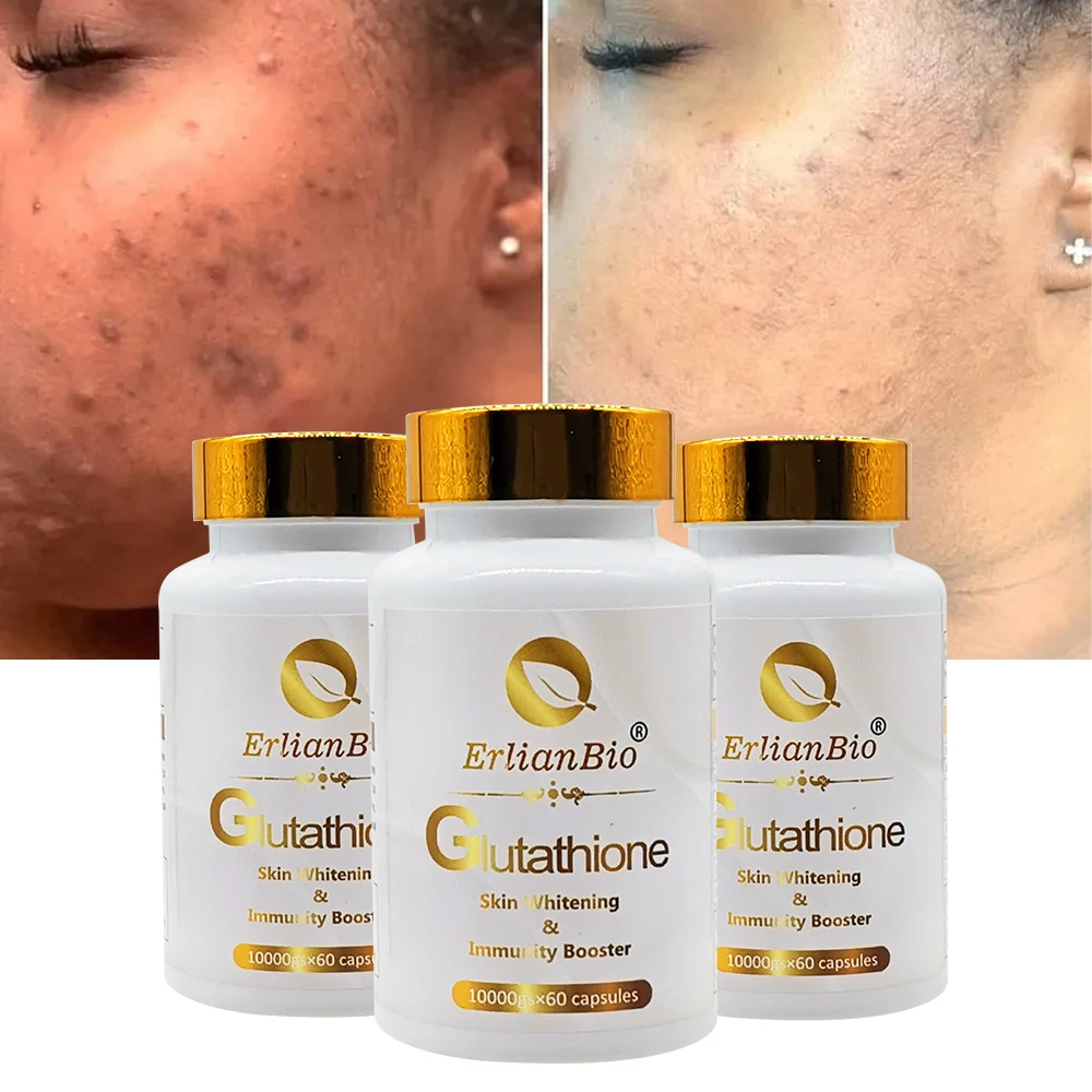 glutathione skin whitening tablet Healing Pharma Agefine Forte (Glutathione + Vitamin C + Alpha Lipoic A main image 0