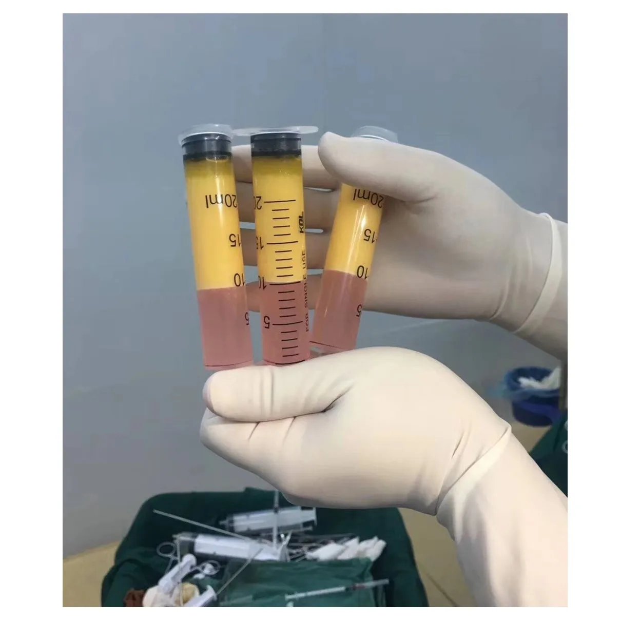 High Quality Stem Cell Fat Transfer Centrifuge for 20cc 50cc Syringes Lipo Suction Treatment Beauty Clinic Use