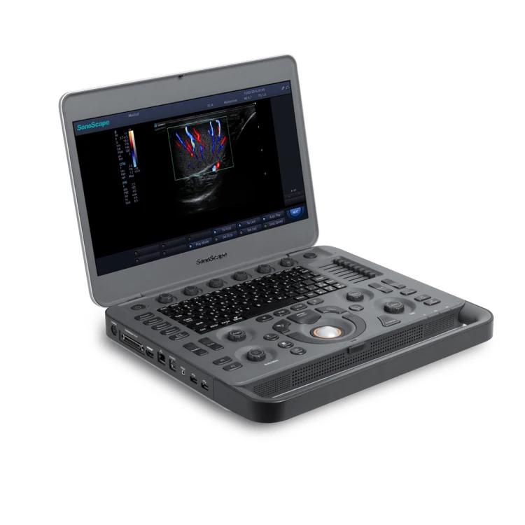 Sonoscape X5 B/ 2B/ 4B/ M/ Gynecology cardiology testing color doppler portable ultrasound with Probe