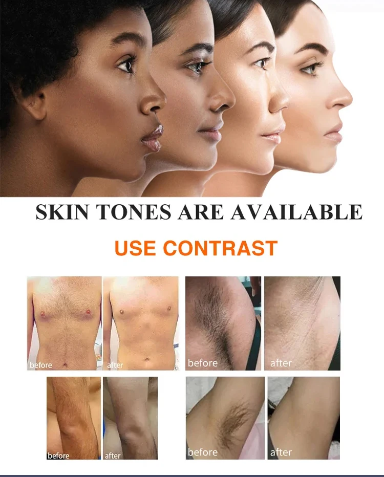 Good PriceLaser Hair Removal Machine Diode Laser  Best Feedback 2 In 1 1064nm Permanent Diode Laser Hair Removal  Machine
