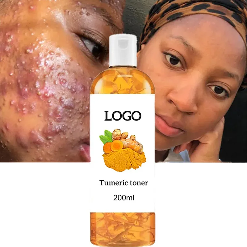 Turmeric Toner