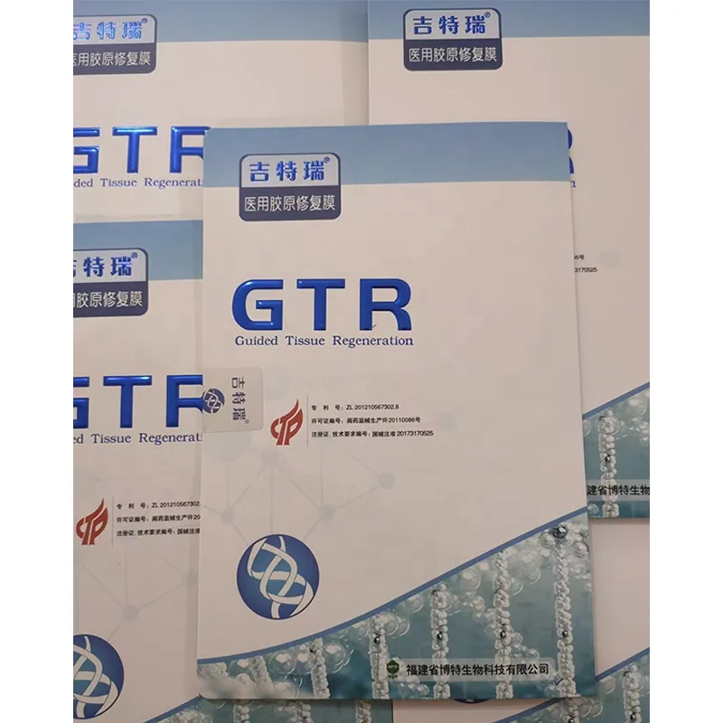 GTR Membrana Reparationis Cavitatis Orales Adultorum Medica Collagena Absorbibilis Biologica Implantatio Dentalis Classis III Cura Orales