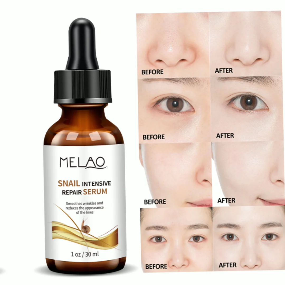 Melao Snail White Serum Wrinkle Anti Aging Collagen Whitening Skin