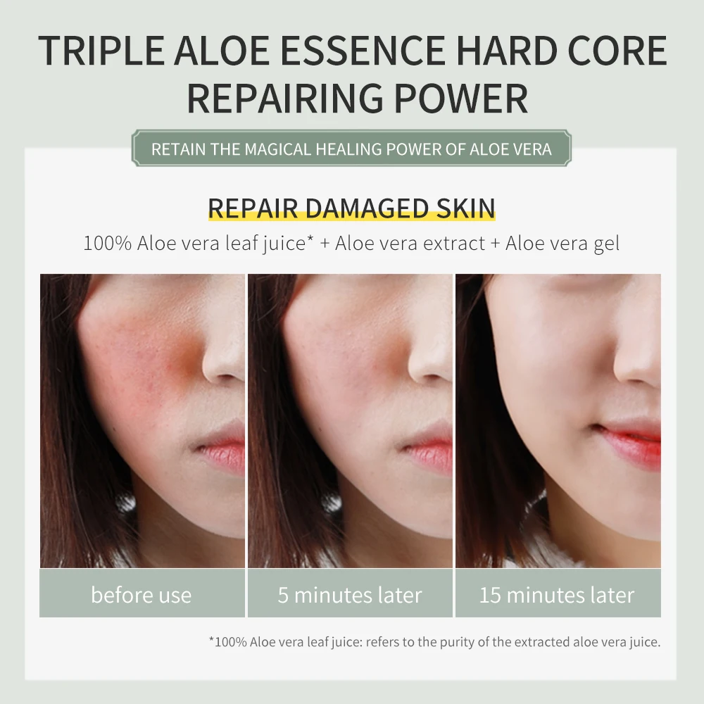 Гель с алоэ вера для ухода за кожей Натуральный гель чистый растительный экстракт