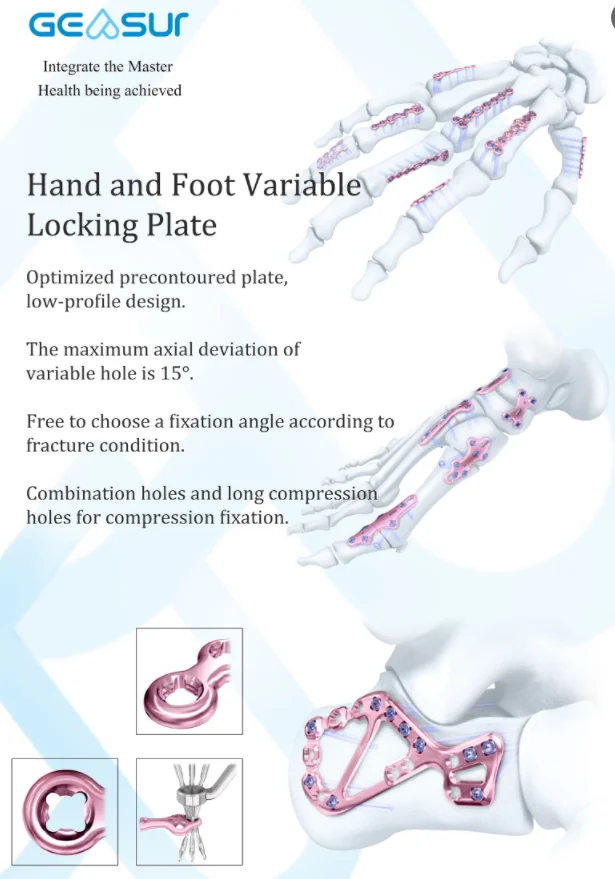 Calcaneus Locking Plate View 2