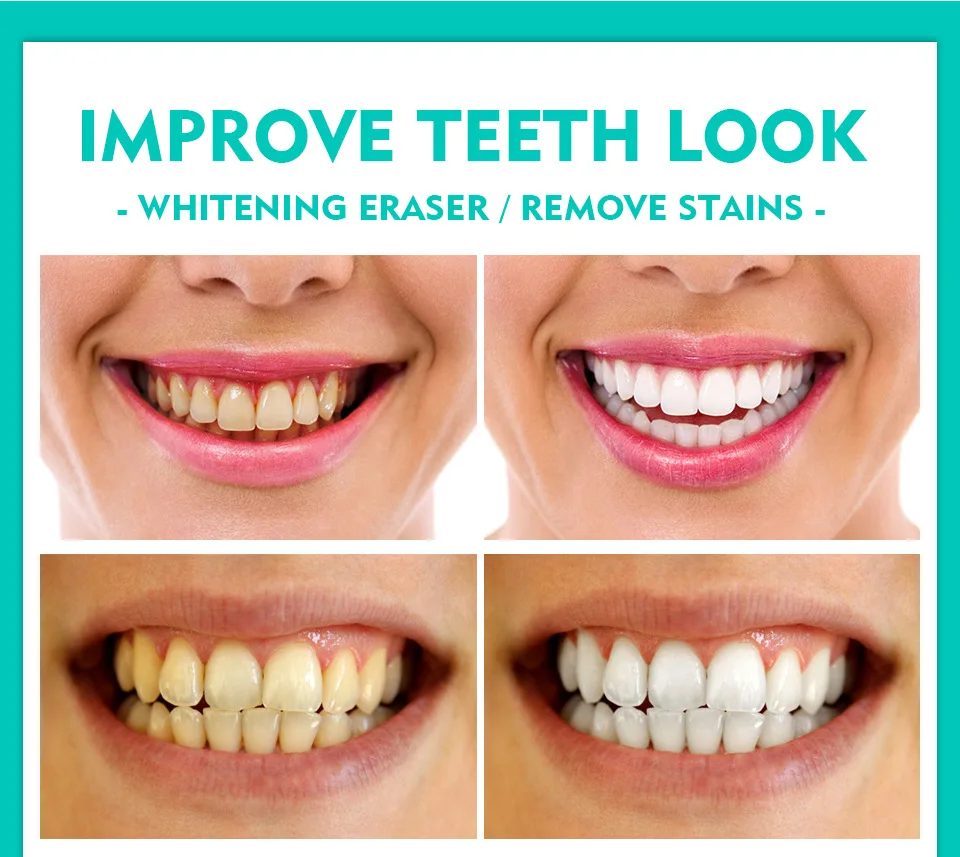 Wholesale VIBRANT GLAMOUR Tooth Whitening Gel Dental Teeth Whitening Tooth Bleaching Pen