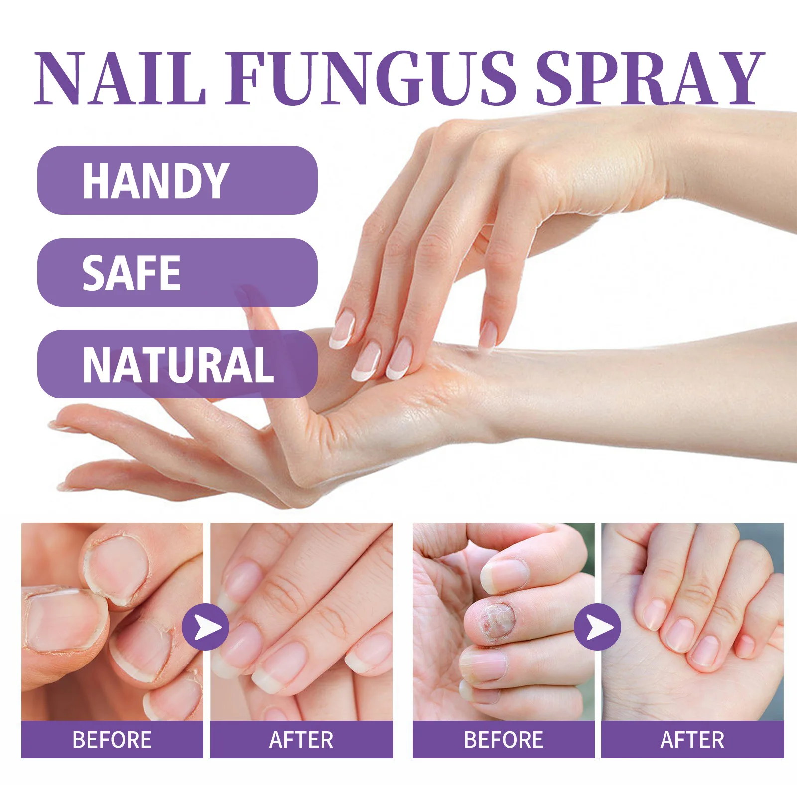 JAYSUING Nail Fungus Products 7 Days Nail Fungus Treatment Spray 100ml