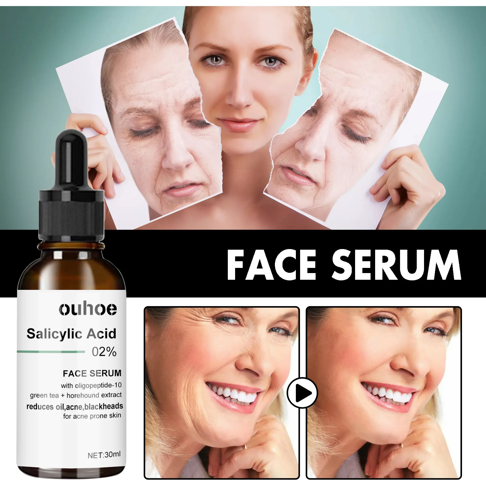 Private Label OUHOE 30ml Organic Extract Skin Moisturizing Anti Wrinkle Salicylic Acid Face Serum
