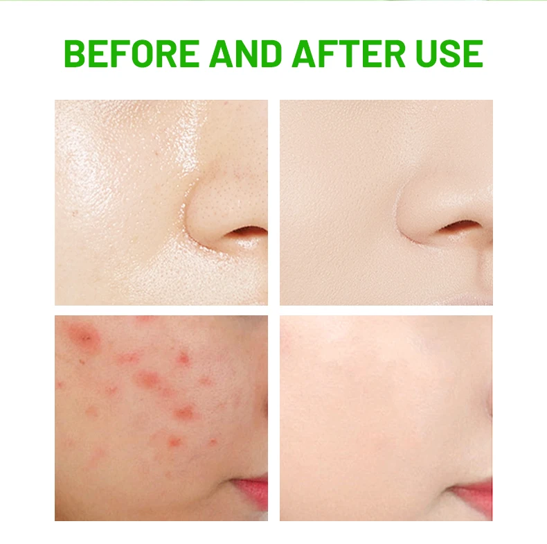 Disaar Rosemary & Centella Face Cleans Wash Deep Cleans Pore Moisturizing Face Repair Acne Oil Control Face Wash for Women