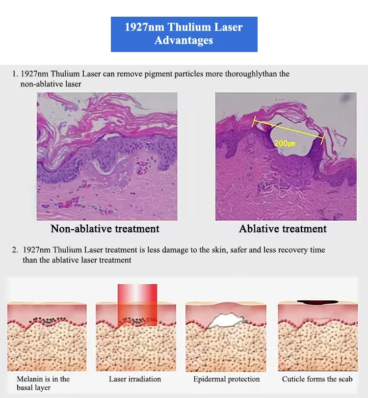 Vertical 12.1-Inch Touch LED Thulium Laser Mask ABS 1927nm Home Care Stimulates Collagen Regeneration Removes Fine Lines