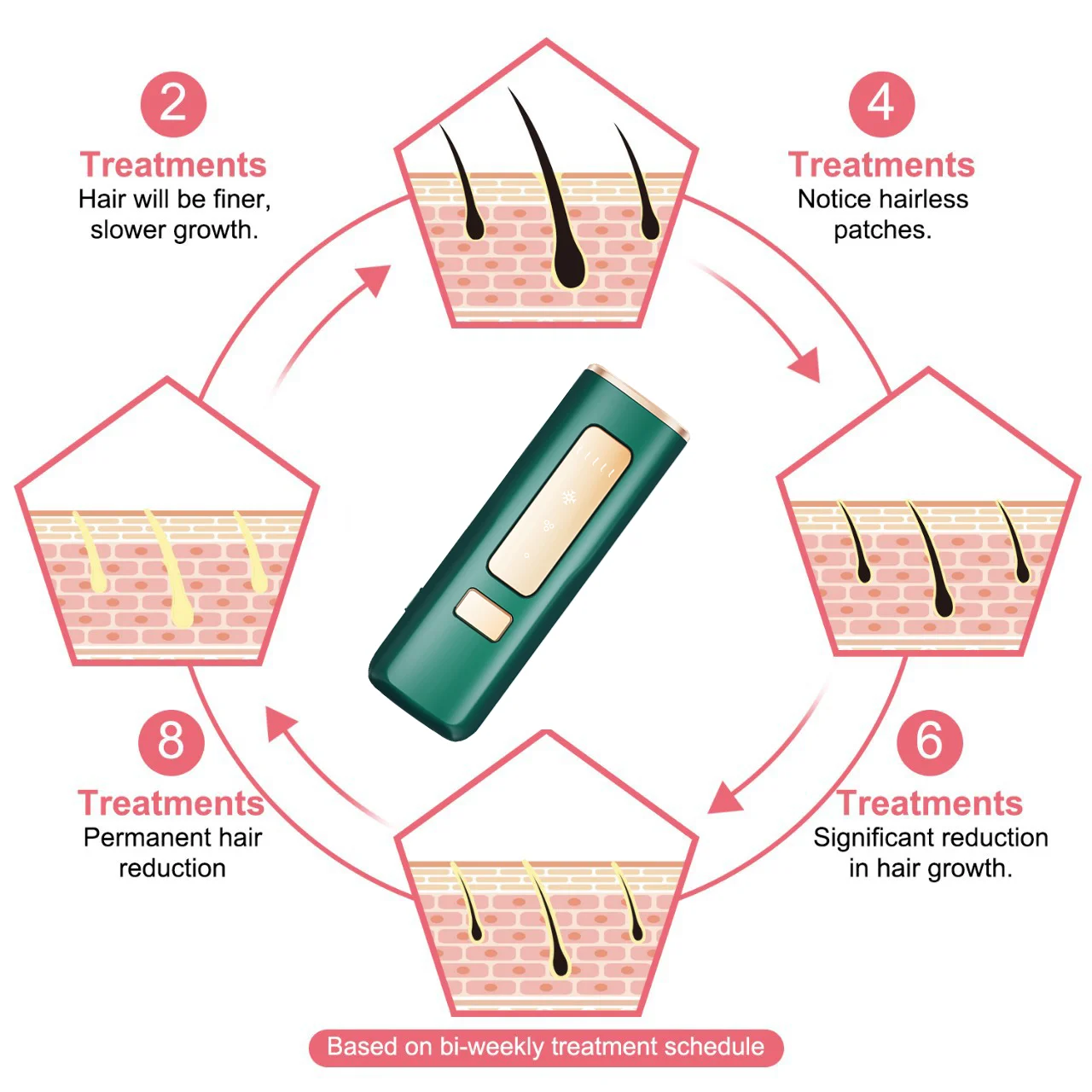 Upgraded To 999,999 Flashes Permanent Ipl Diode Laser Hair Removal With