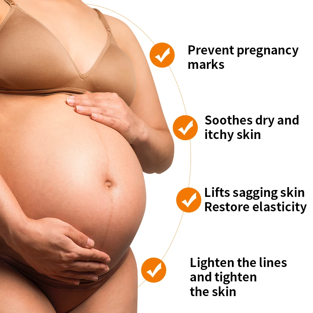 Best Effective Stretch Mark and Scar Removal Cream After Pregnancy Treatment Stretch Marks Remover Cream for Female