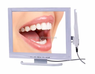 Intra Oral Wireless Camera Scanner for Mobile Phones