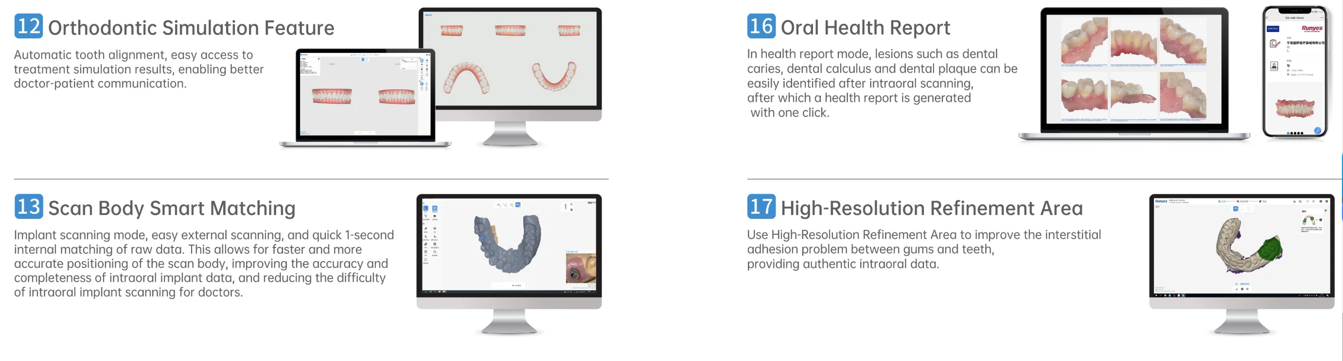 3D Digital Dental Runyes V5 Intraoral Scanner 
