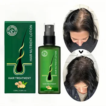 Private label fast hair regrowth treatment spray hair growth serum Nutrient Solution for man and women