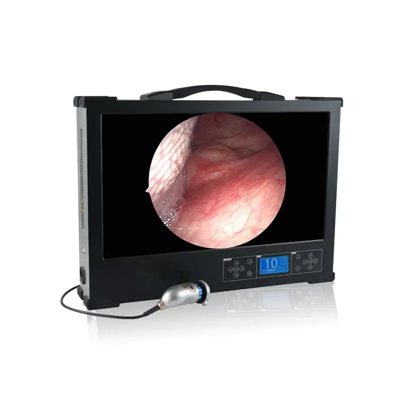 All-in-One Portable Endoscope Camera System professional medical devices 4K Screen with Monitor and Light Source