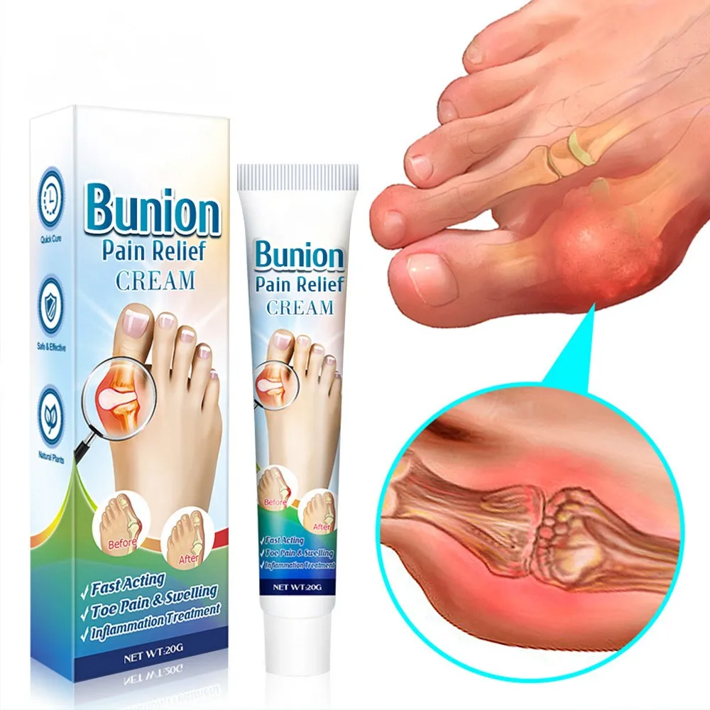 Oem Bunion Cream Skin Topical Cream For Quick Pain Relief And Increased ...