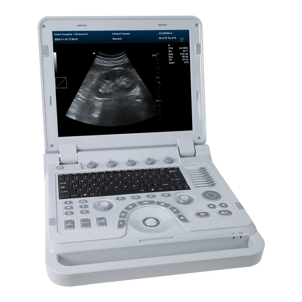 CONTEC CMS1700B Multiple 3D 4D Probe Digital Human Ultrasound Scan Ecocardiografo Color Doppler ultra Sound Machine