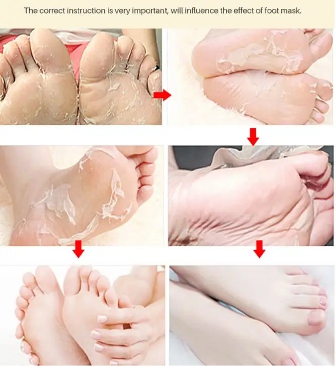 Отшелушивающая маска для