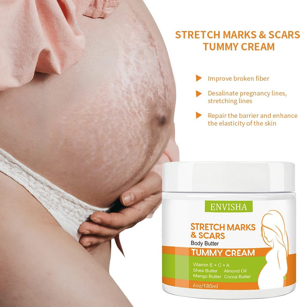 Best Effective Stretch Mark and Scar Removal Cream After Pregnancy Treatment Stretch Marks Remover Cream for Female