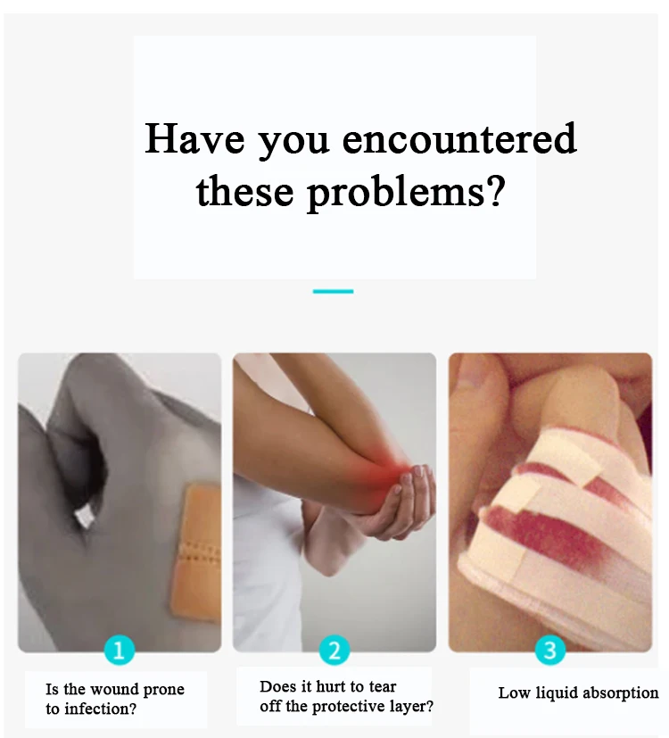 Ce/iso Certificated Alginate Silver Dressing For Burns Wound Buy