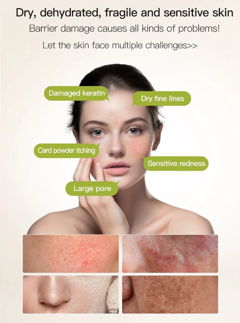 Icesea Gentle Roman Chamomile Herbal Hypoallergenic Face Serum for Sensitive Skin Moisturizing Strengthening Barrier(pic1)