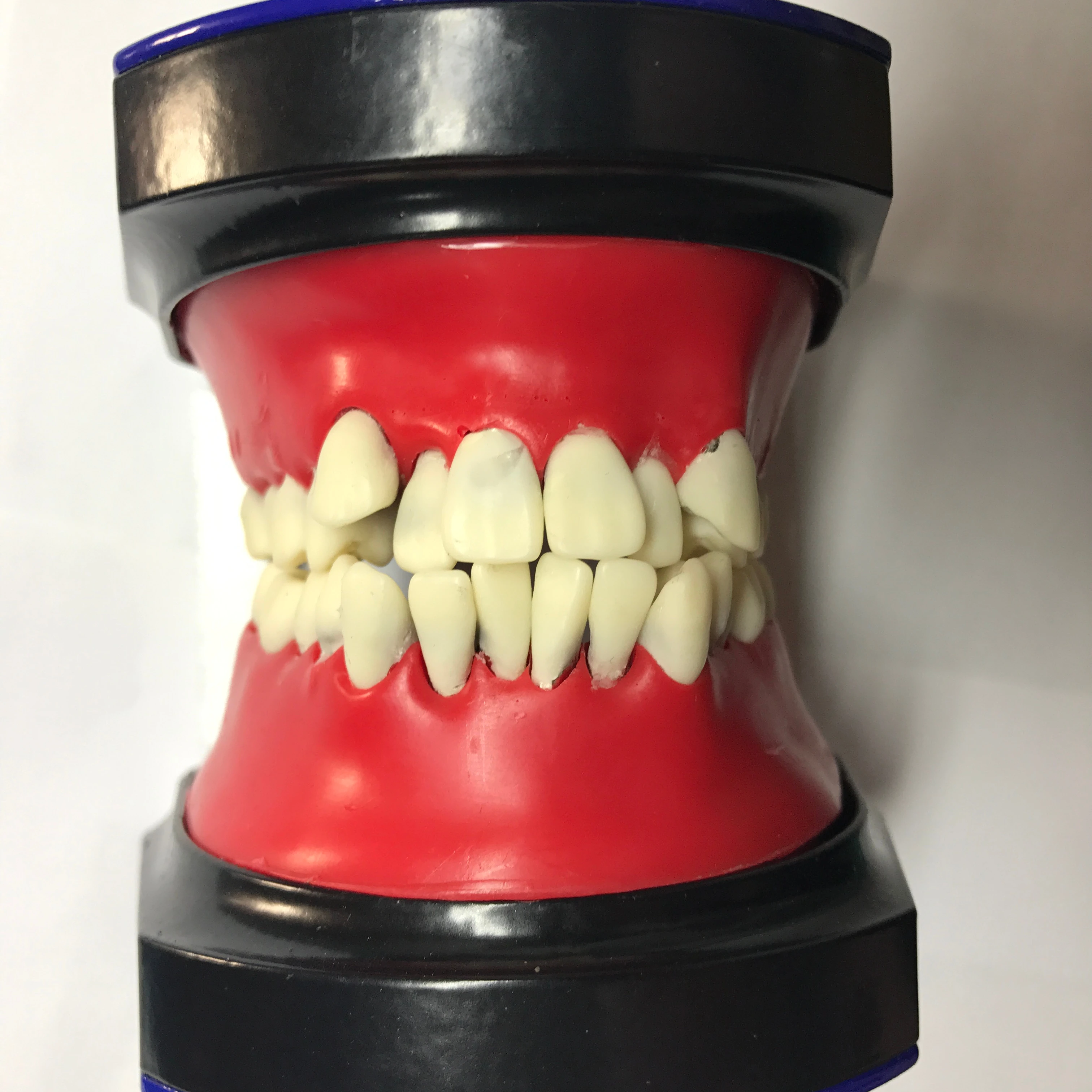 Orthodontic Practice Typodont with Wax and Teeth
