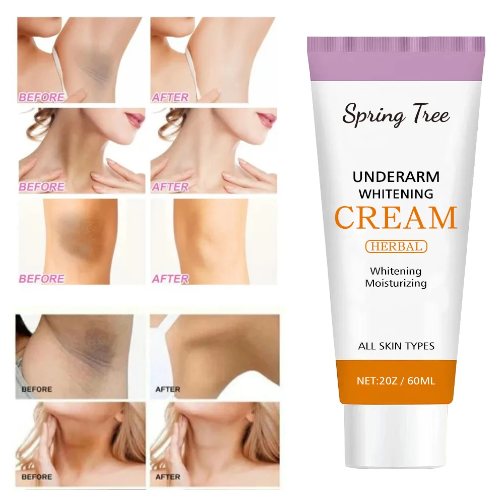 Spring Tree Body and Underarm Lightening Cream Whitening Cream for Dark Skin