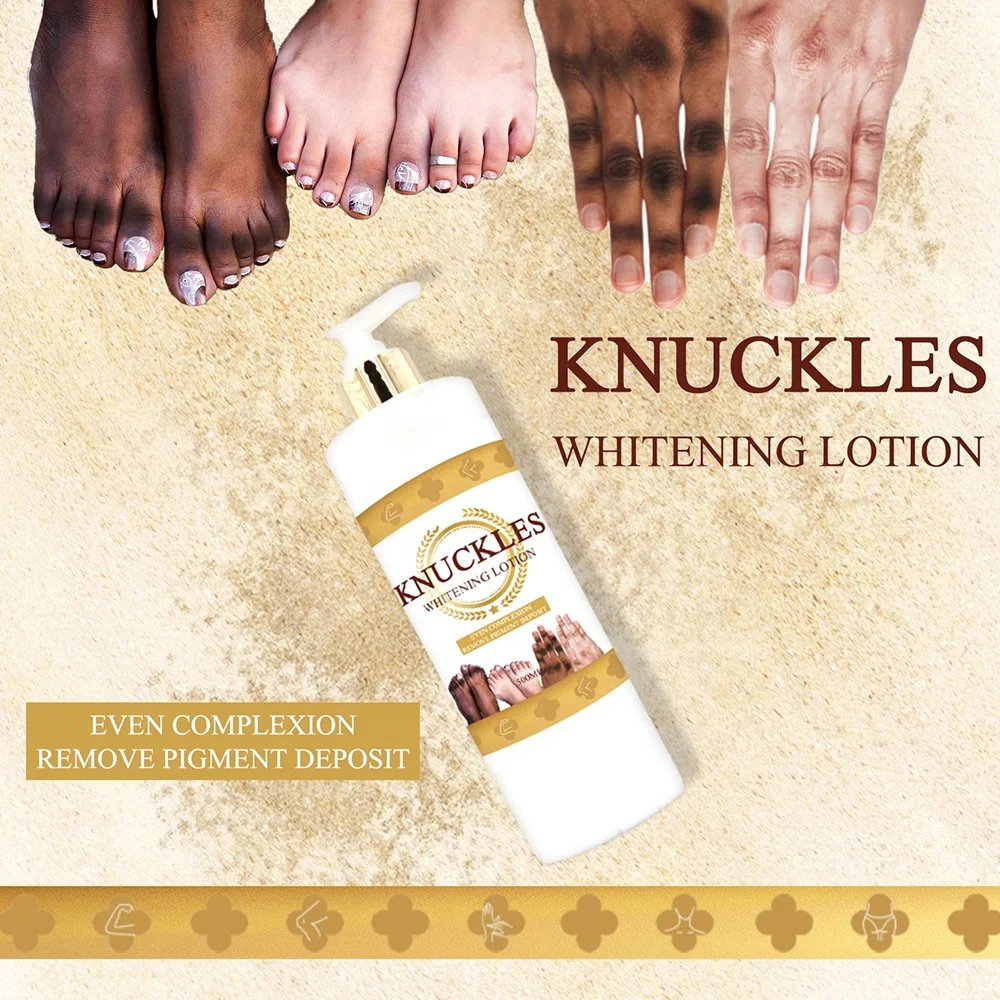 Eliminate Dark Knuckles on Toes with Our Skin Solution