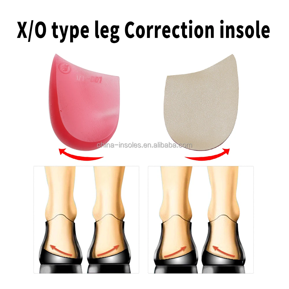 Free Samples Foot Alignment Bow Legs O/X Leg Correction Shoe Inserts